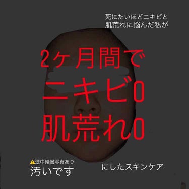 ジョンソン・エンド・ジョンソン テラ・コートリル 軟膏(医薬品)のクチコミ「⚠️第3段まで続きます。




こんにちは！！！
高校1年生のPotchと申します。


私.....」（1枚目）