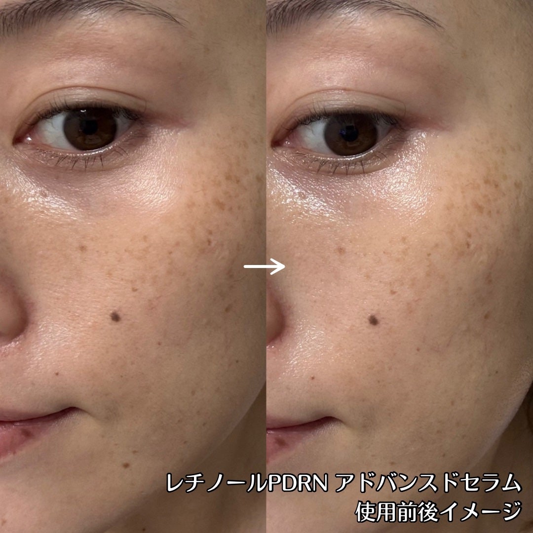 レチノール シカ リペア セラム/innisfree/美容液を使ったクチコミ(5枚目)