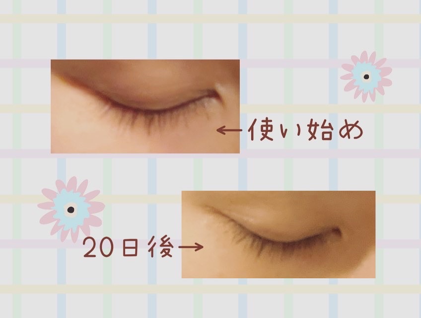 アイラッシュセラム/VIYEUX/まつげ美容液を使ったクチコミ（3枚目）