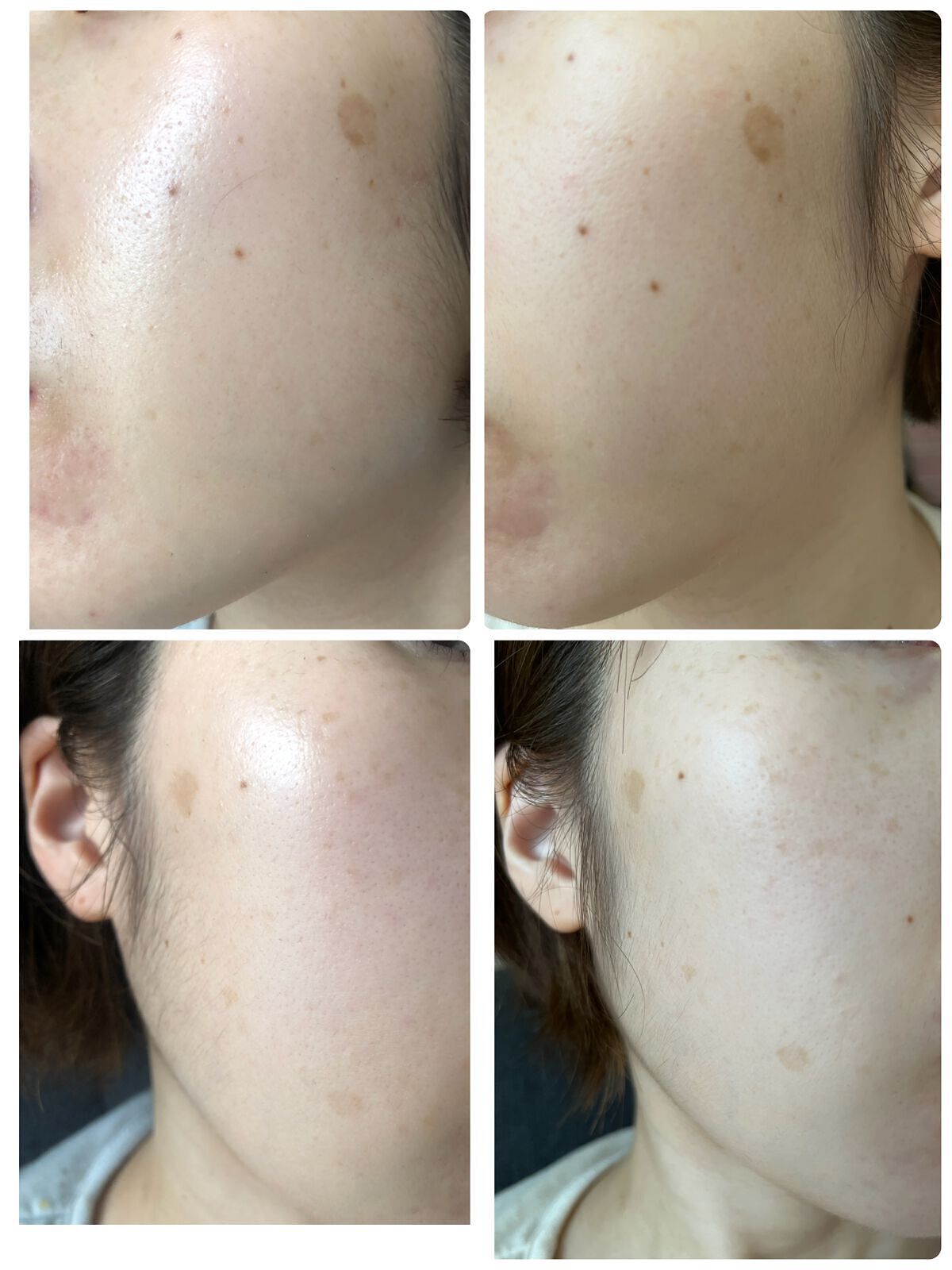 コンディショニング リキッド/ラシェリエ/化粧水を使ったクチコミ(1枚目)