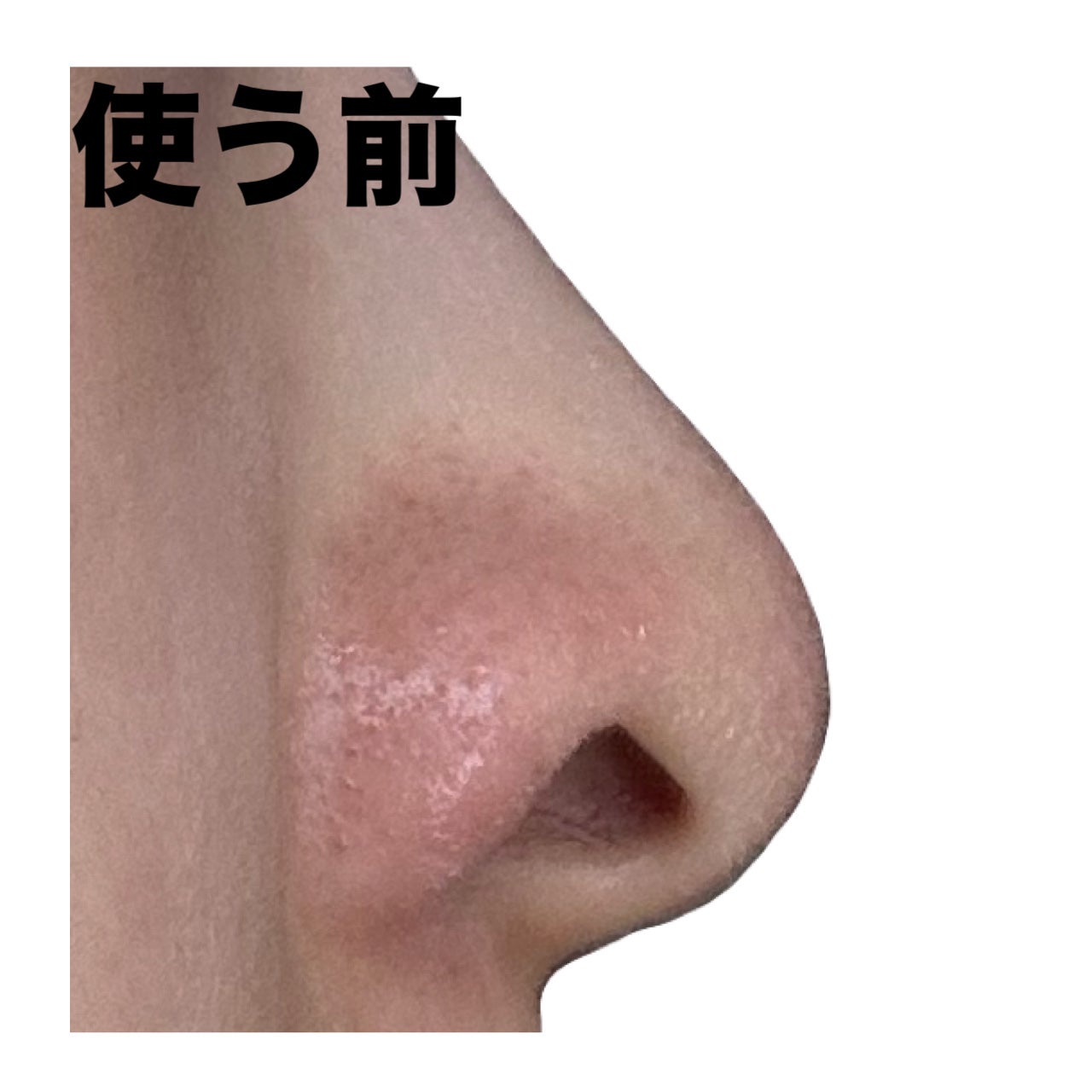 ノーズピーリングパック/One-day's you/シートマスク・パックを使ったクチコミ(6枚目)