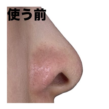 ノーズピーリングパック/One-day's you/シートマスク・パックを使ったクチコミ(6枚目)