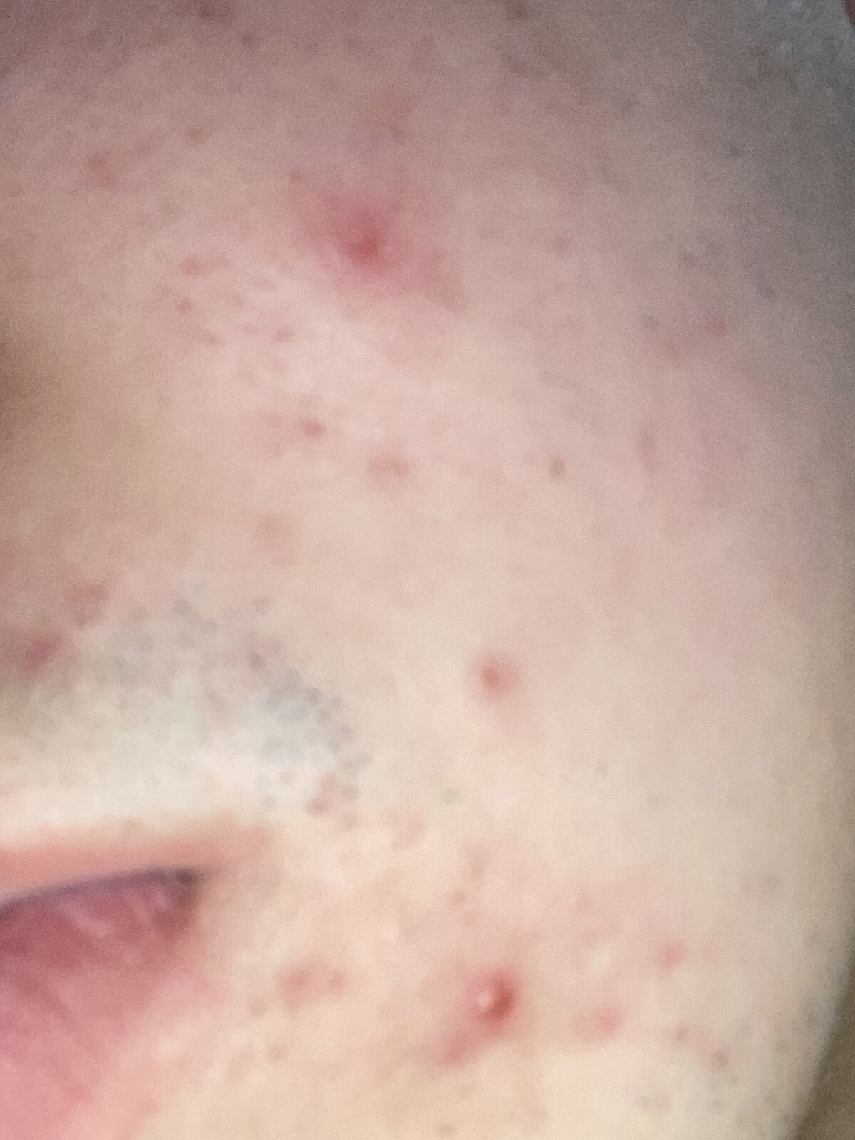 リペアソープ/コラージュリペア/洗顔石鹸を使ったクチコミ（2枚目）