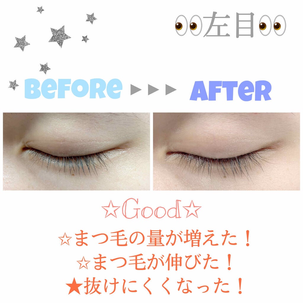 スカルプD ボーテ ピュアフリーアイラッシュセラム プレミアム/アンファー(スカルプD)/まつげ美容液を使ったクチコミ(2枚目)