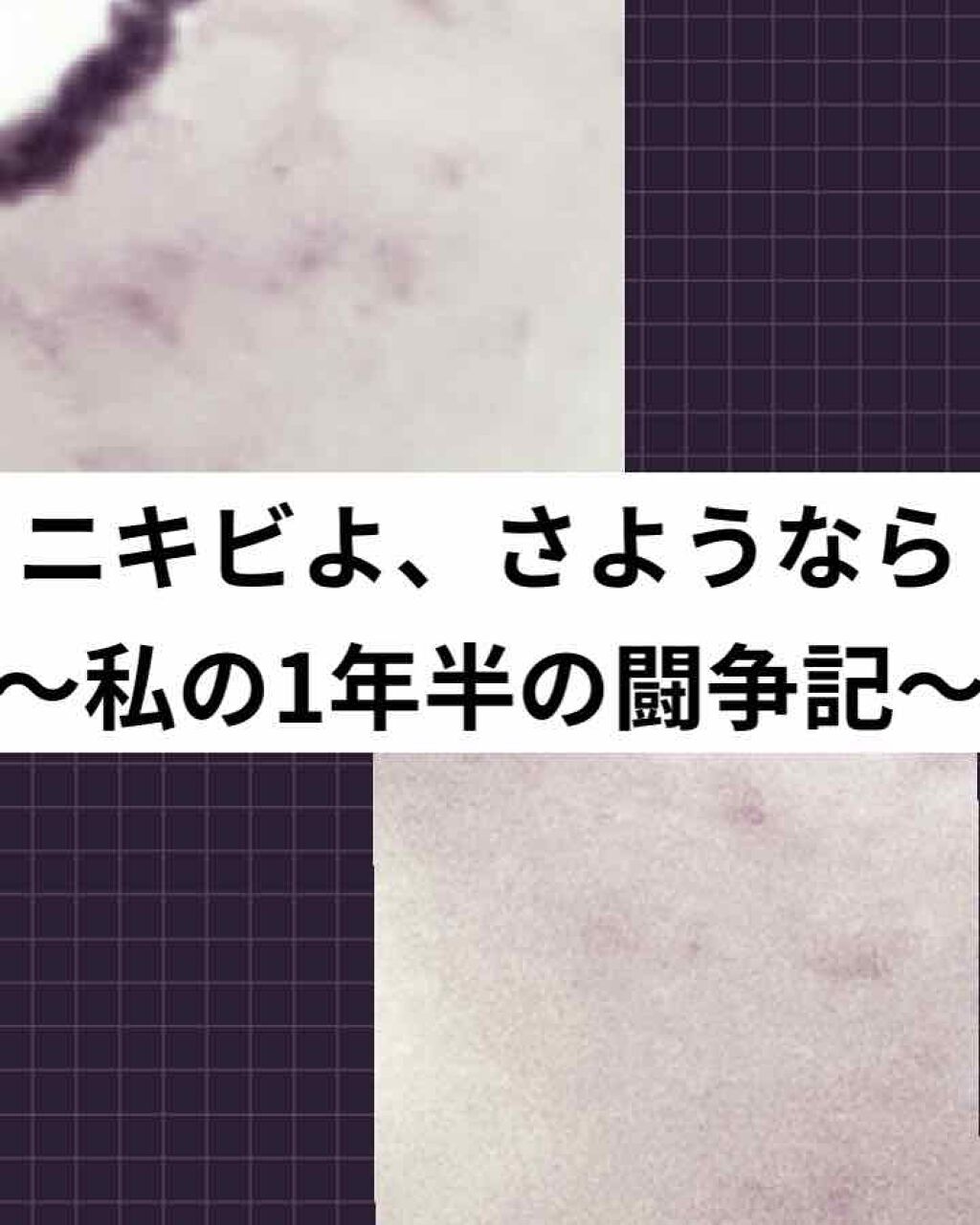 ホワイトニングクリア ローション/d プログラム/化粧水を使ったクチコミ(1枚目)