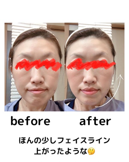 kumi◡̈*.k222 on LIPS 「メイク以上整形未満で『貼るリフトアップ』のKAZKIREIKO..」(4枚目)