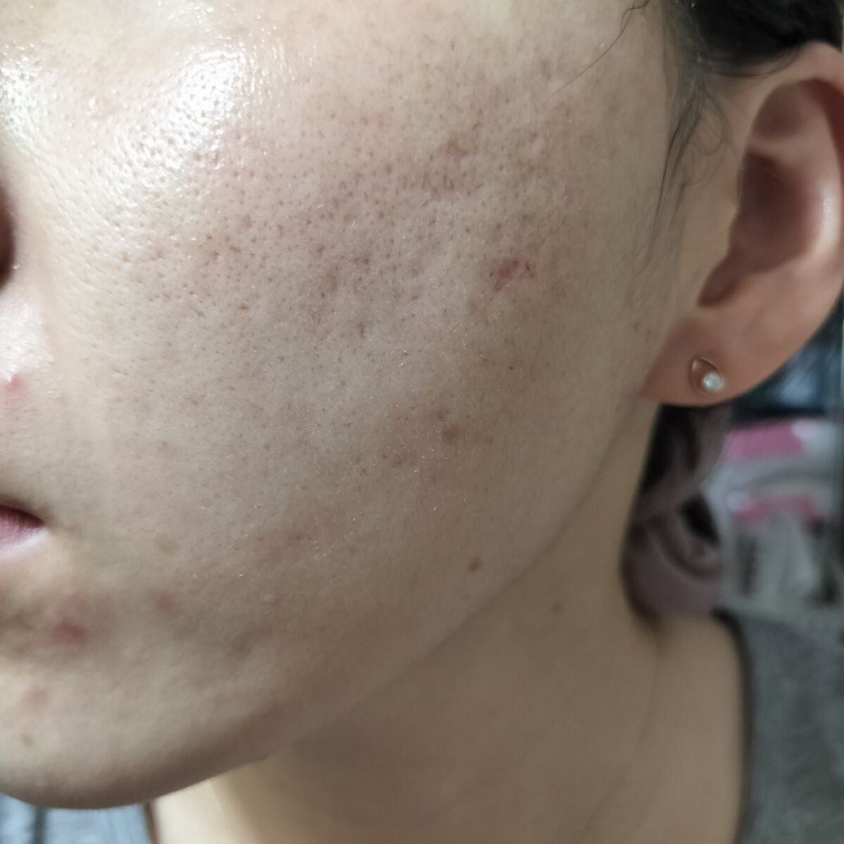 メラノフォーカスZ/HAKU/美容液を使ったクチコミ(2枚目)