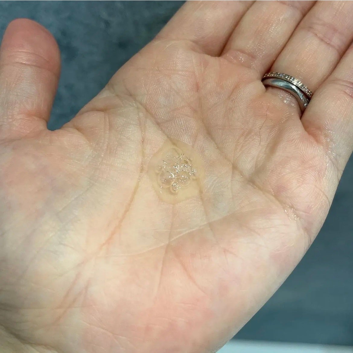 ナイアシンアミドブレミッシュケアセラム/ONE THING/美容液を使ったクチコミ(4枚目)