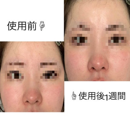 スキンパワー アドバンスト クリーム/SK-II/フェイスクリームを使ったクチコミ(3枚目)