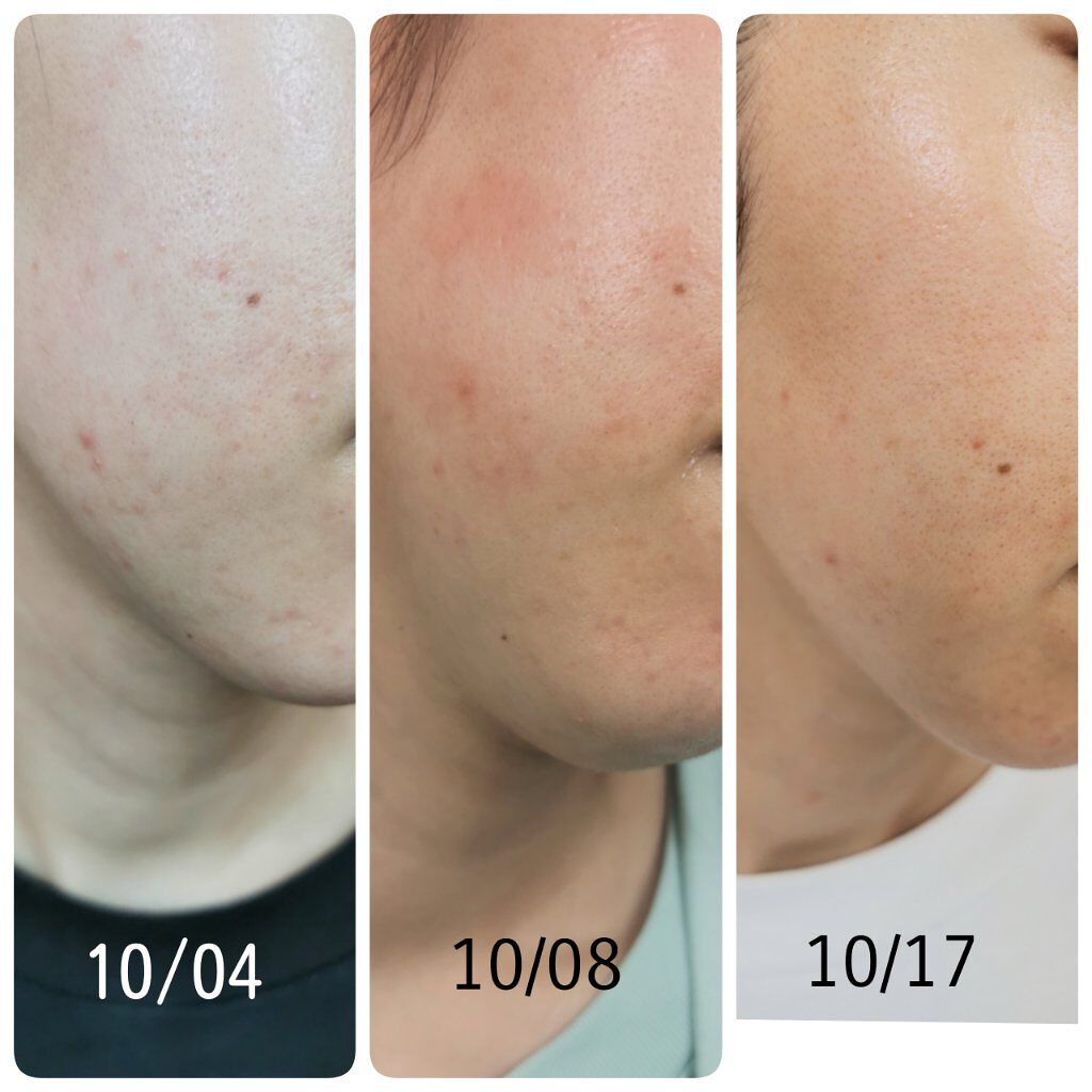 クリアウォッシュ/オルビス/洗顔フォームを使ったクチコミ(4枚目)