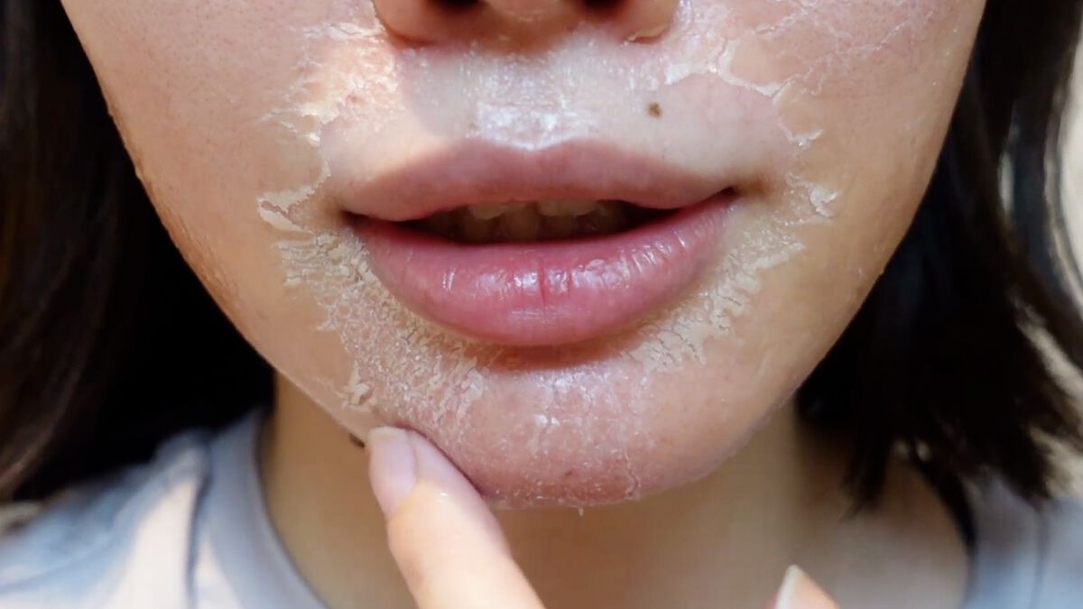 ゾンビビューティー ゾンビパック/SKIN1004/シートマスク・パックを使ったクチコミ(9枚目)