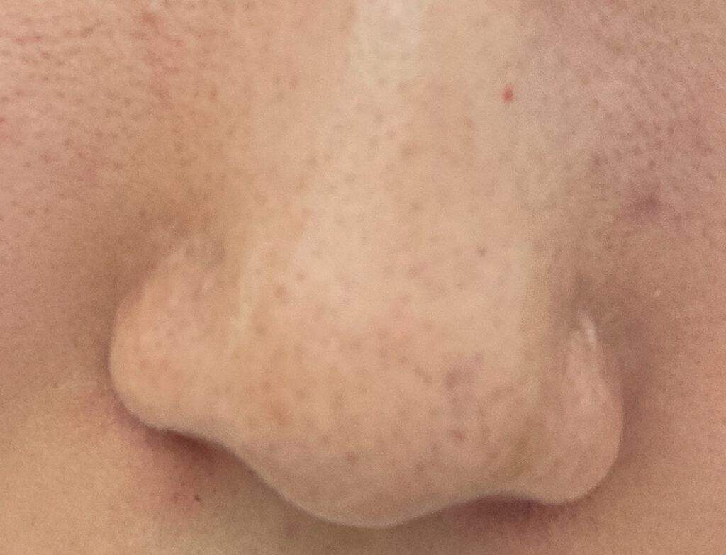 デュオ ザ クレンジングバーム ブラックリペア /DUO/クレンジングバームを使ったクチコミ(2枚目)