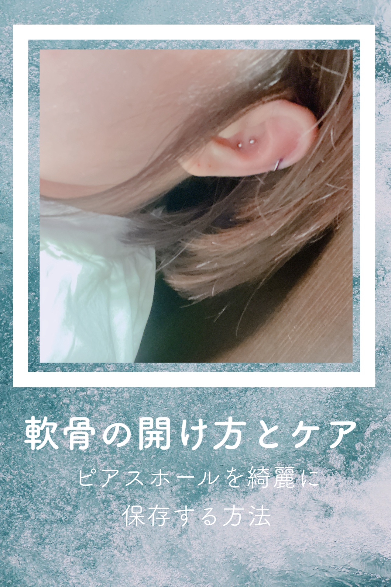 オロナインＨ軟膏 (医薬品)/オロナイン/その他を使ったクチコミ（1枚目）