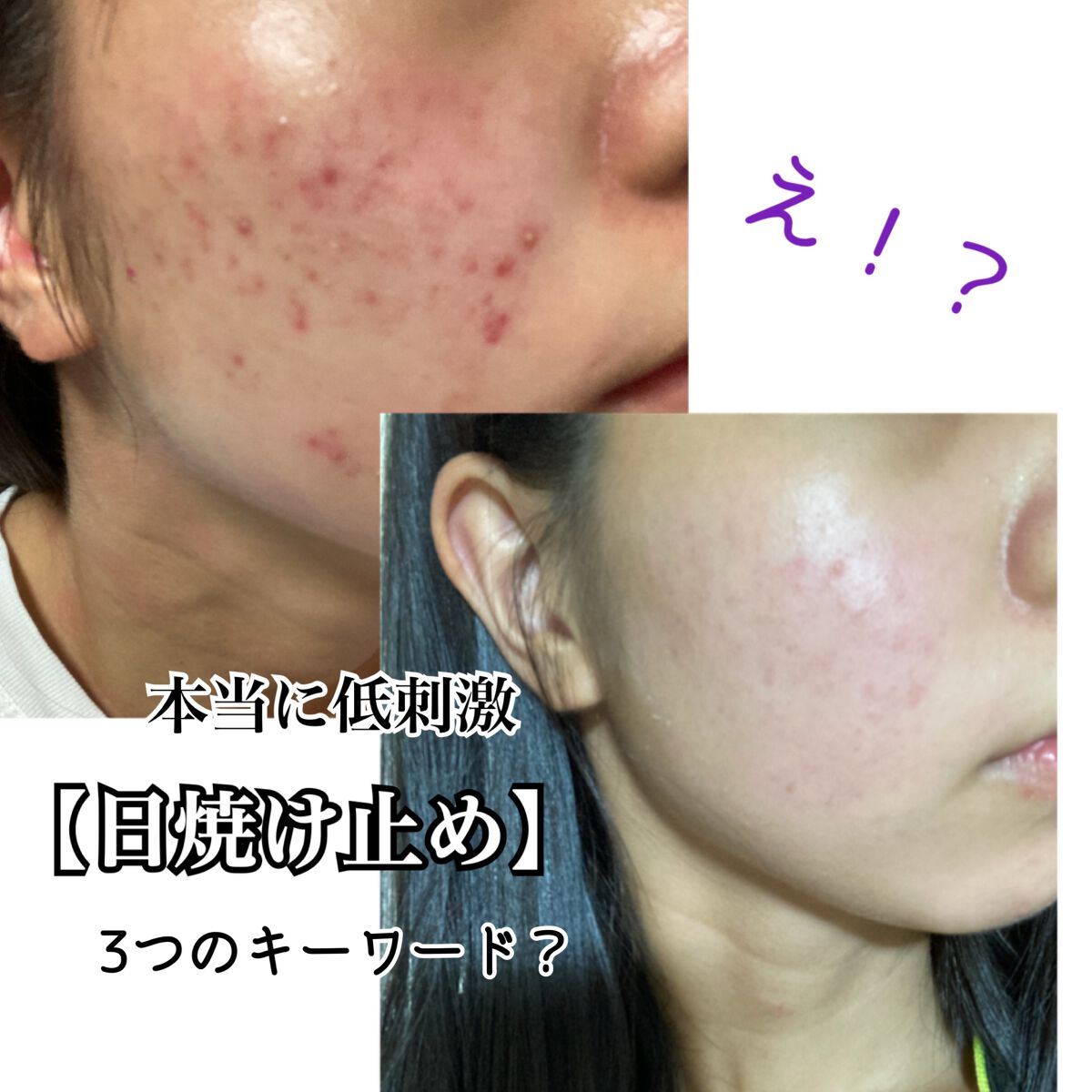 UVマイルドジェルN/マミー/日焼け止めジェルを使ったクチコミ（1枚目）