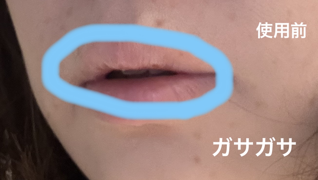 モアリップ N (医薬品)/資生堂薬品/その他を使ったクチコミ（3枚目）