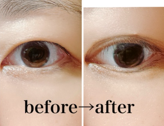 メザイク イージークリア 接着クリアタイプ/メザイク/二重まぶた用アイテムを使ったクチコミ（1枚目）