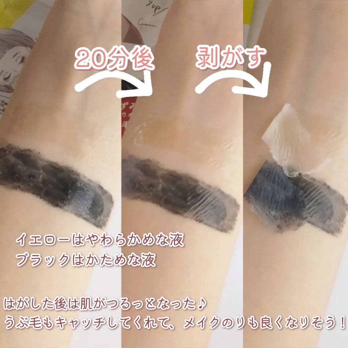 æ¯ç©Žå°çº ãã©ãã¯ããŒã«ãªãããã¯/ã¯ãªã¢ã¿ãŒã³/ããŒãªã³ã°ã䜿ã£ãã¯ãã³ãïŒ4æç®ïŒ