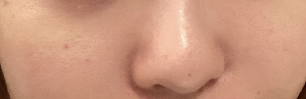 ドクダミ 77 スージングトナー/Anua/化粧水を使ったクチコミ（3枚目）