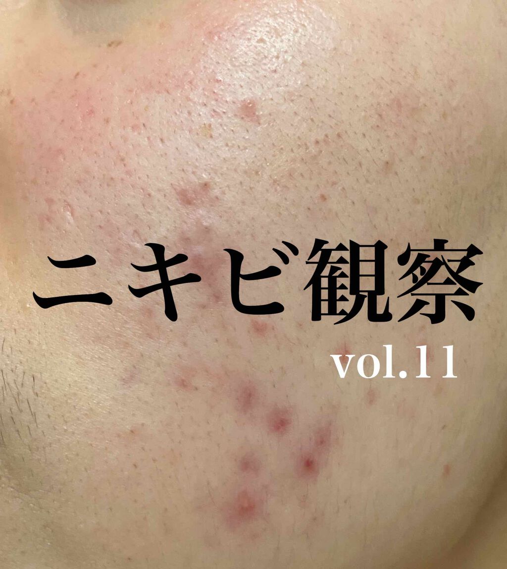 DETクリア ブライト&ピール フルーツ酵素パウダーウォッシュ/Detclear/洗顔パウダーを使ったクチコミ（1枚目）