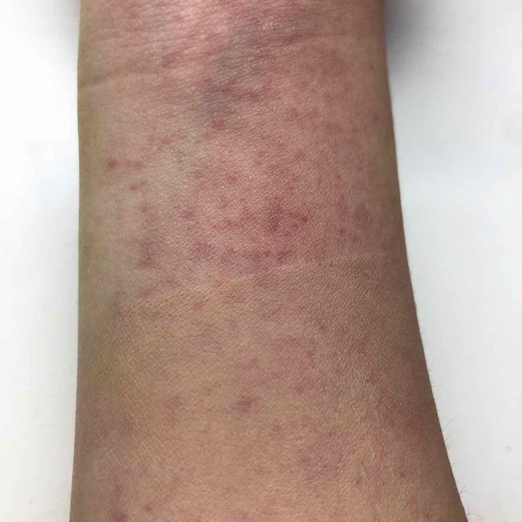 パウダリースキンメイカー/KATE/リキッドファンデーションを使ったクチコミ（2枚目）