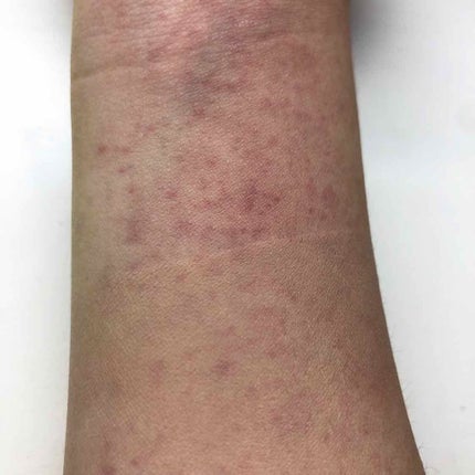 【旧品】マシュマロフィニッシュパウダー/キャンメイク/プレストパウダーを使ったクチコミ(2枚目)