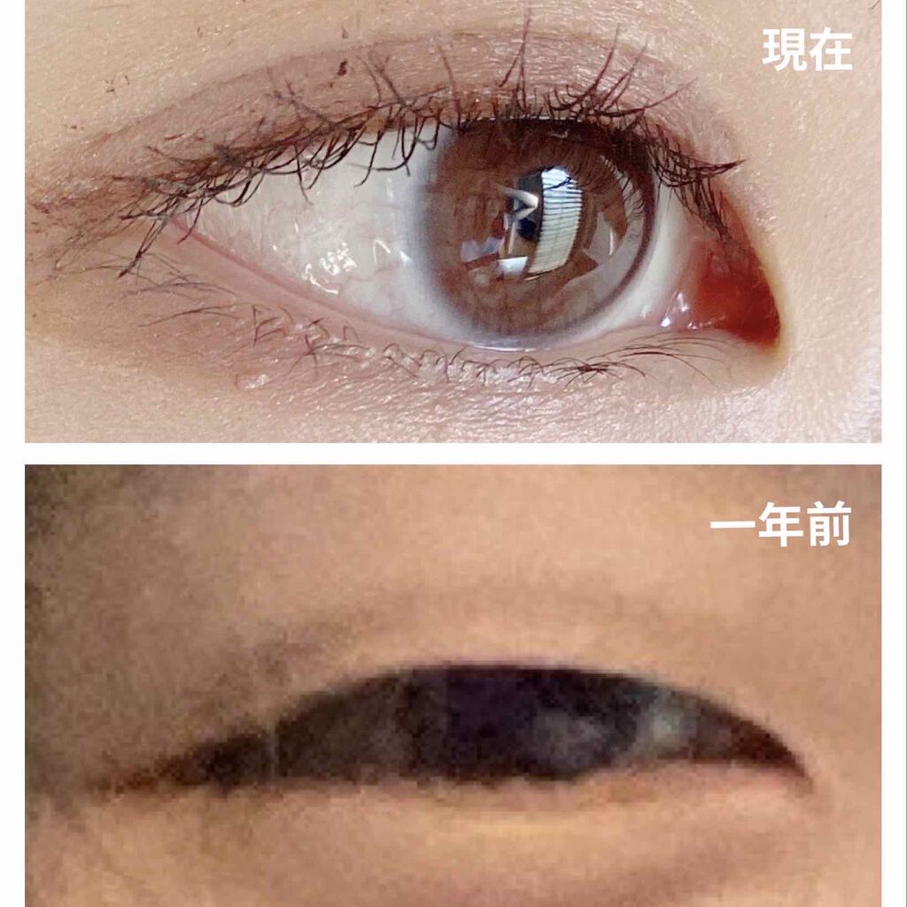 アイビューティー フィクサー WP/アストレア ヴィルゴ/二重まぶた用アイテムを使ったクチコミ（2枚目）