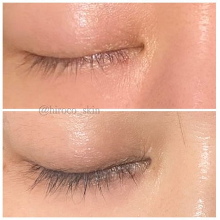 EMAKED(エマーキット)/水橋保寿堂製薬/まつげ美容液を使ったクチコミ(6枚目)