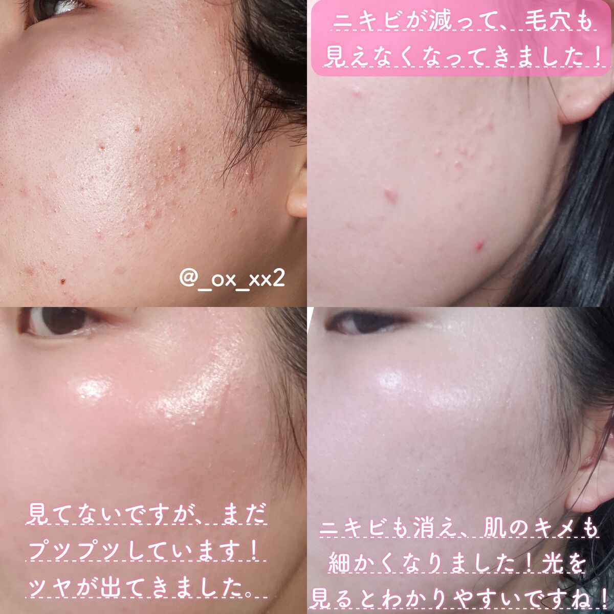 ピュア クレンジング オイル/manyo/オイルクレンジングを使ったクチコミ(3枚目)