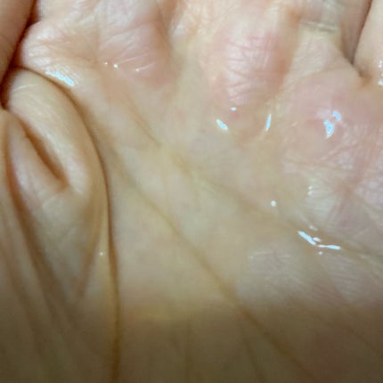 VCスターターセット/VCシリーズ/スキンケアキットを使ったクチコミ(5枚目)