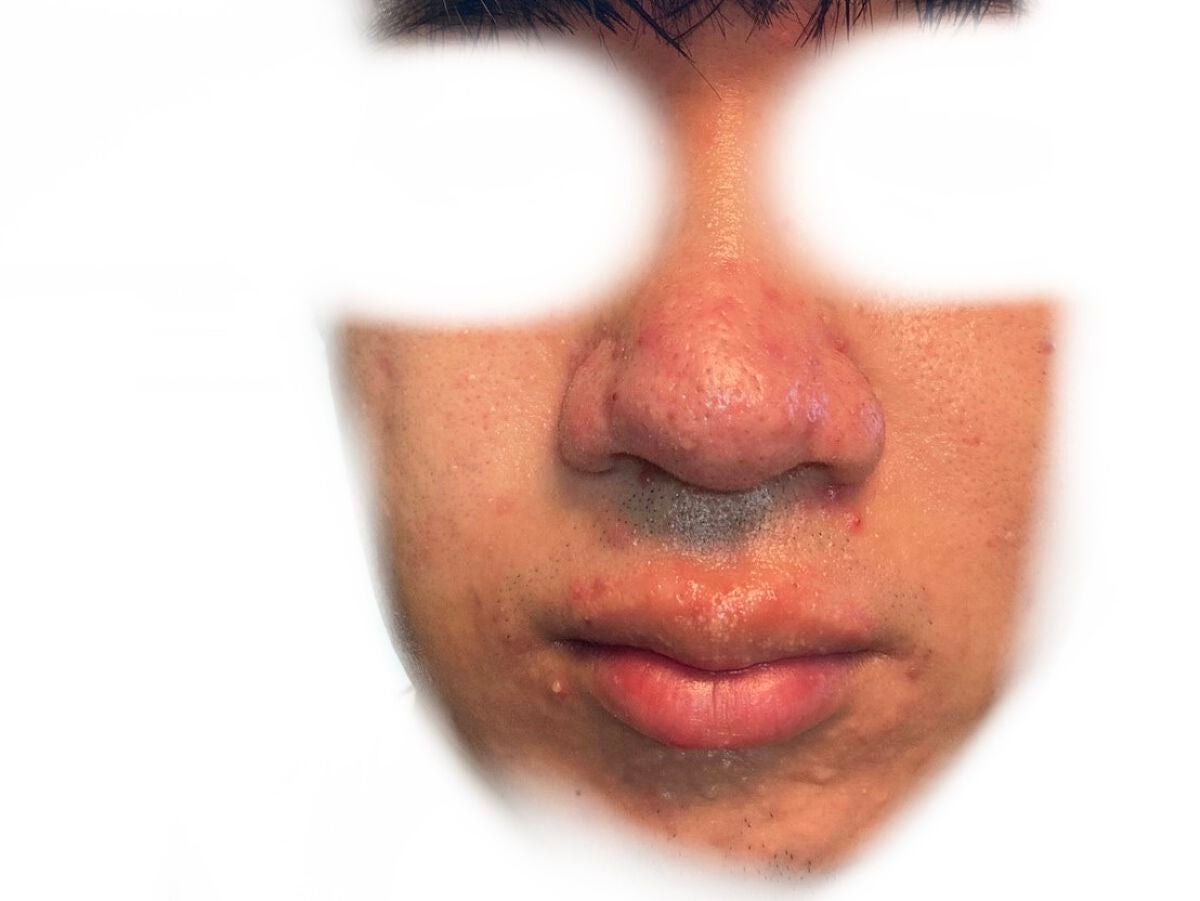 (フォロバ)3年後に韓国美男子 on LIPS 「CICA×HYALONフェスパック使用回数:18枚目特徴5:1..」(2枚目)