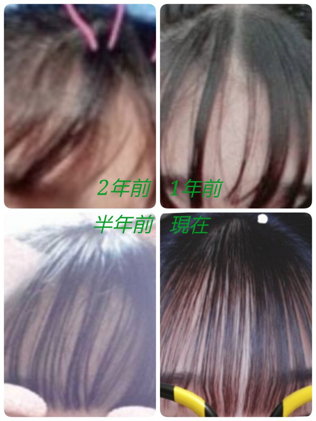 ケープ スーパーハード 無香料/ケープ/ヘアスプレーを使ったクチコミ（1枚目）