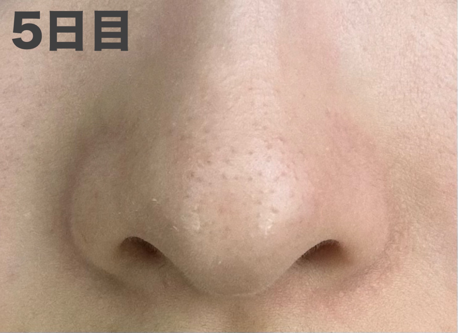 おうちdeエステ 肌をなめらかにするマッサージ洗顔ジェル 炭/ビオレ/その他洗顔料を使ったクチコミ（2枚目）