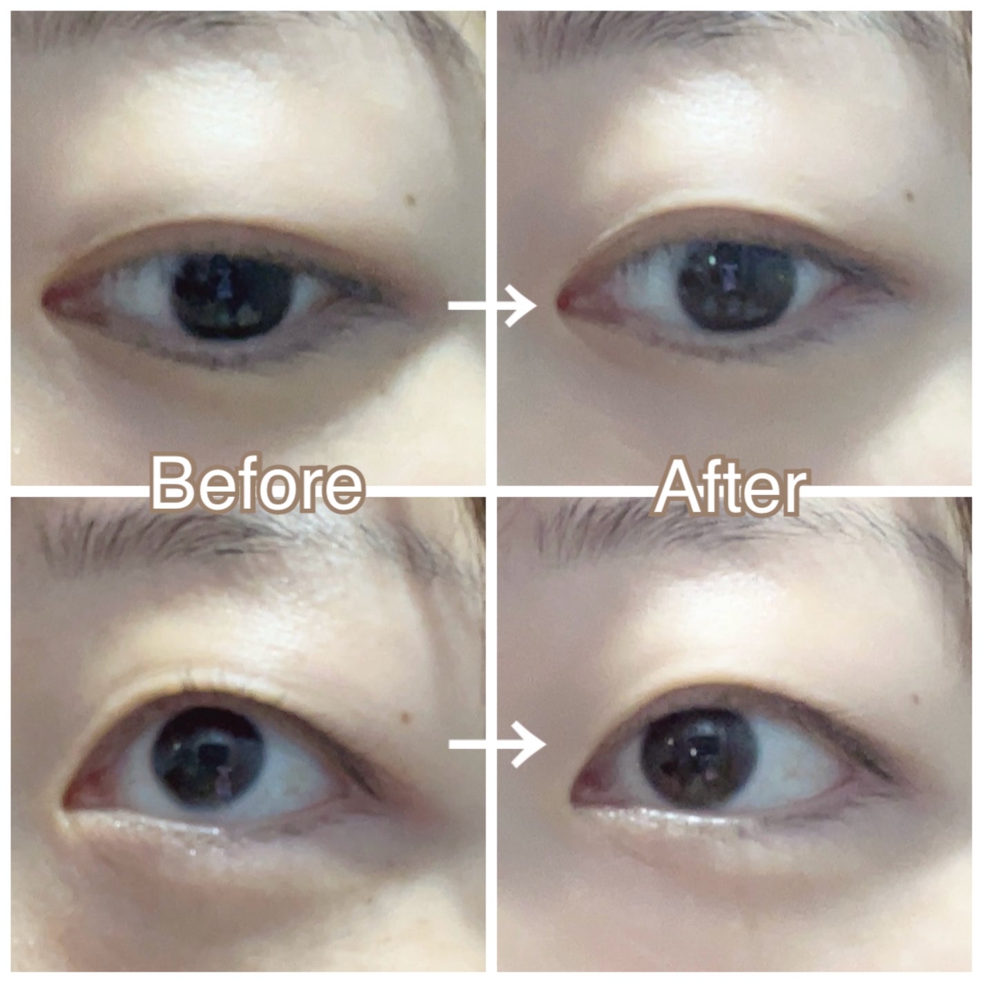 TWOOLダブルアイリッドハイブリットフィルム/SHOBIDO/二重まぶた用アイテムを使ったクチコミ(4枚目)