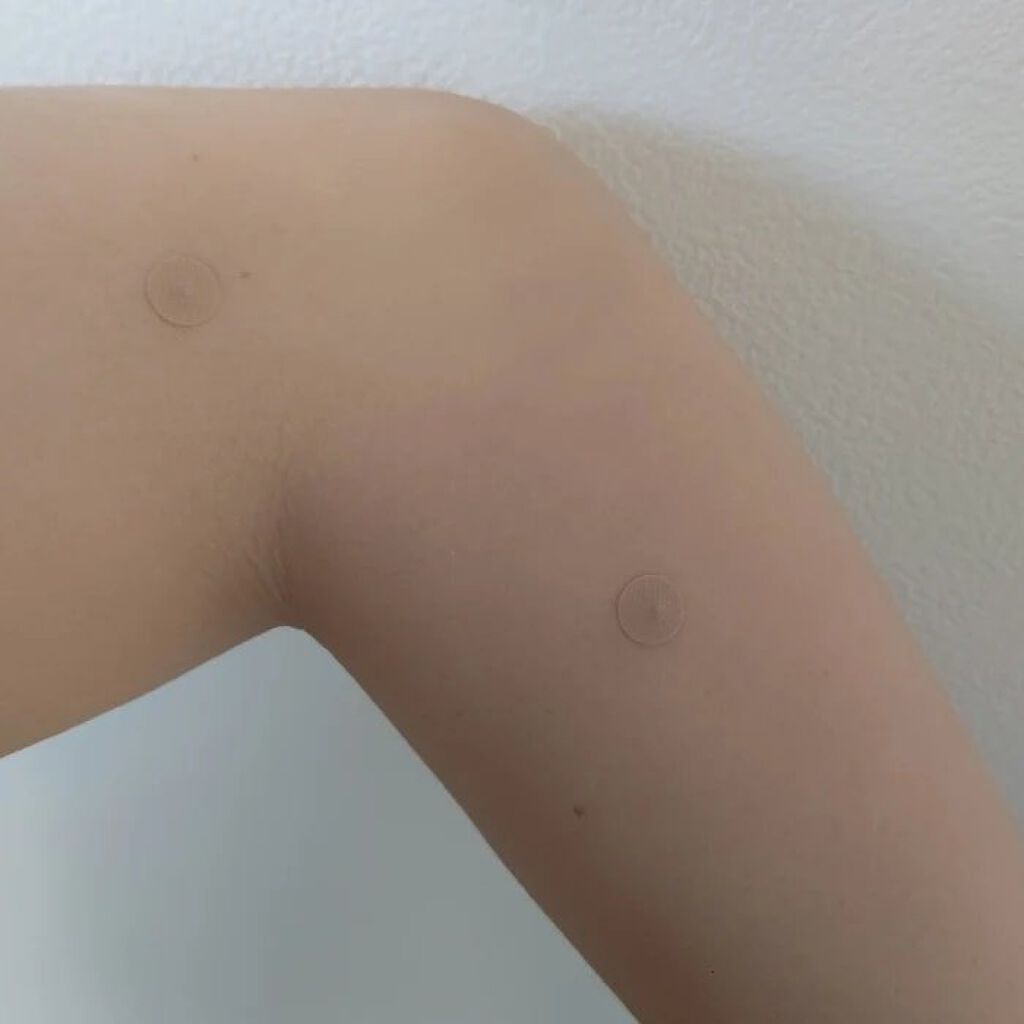 ささない鍼アキュライフ/ペネロピムーン/その他を使ったクチコミ（3枚目）