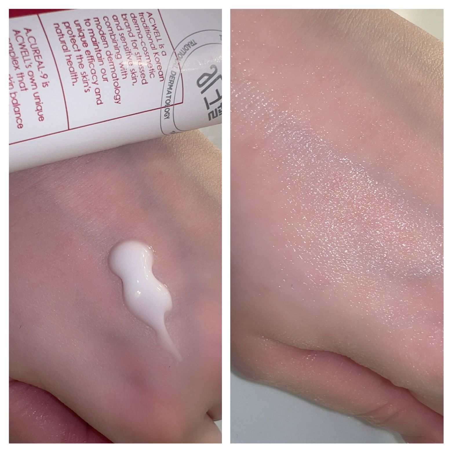 アキュリアルナインコントロールエックスクリーム/ACWELL/フェイスクリームを使ったクチコミ（2枚目）