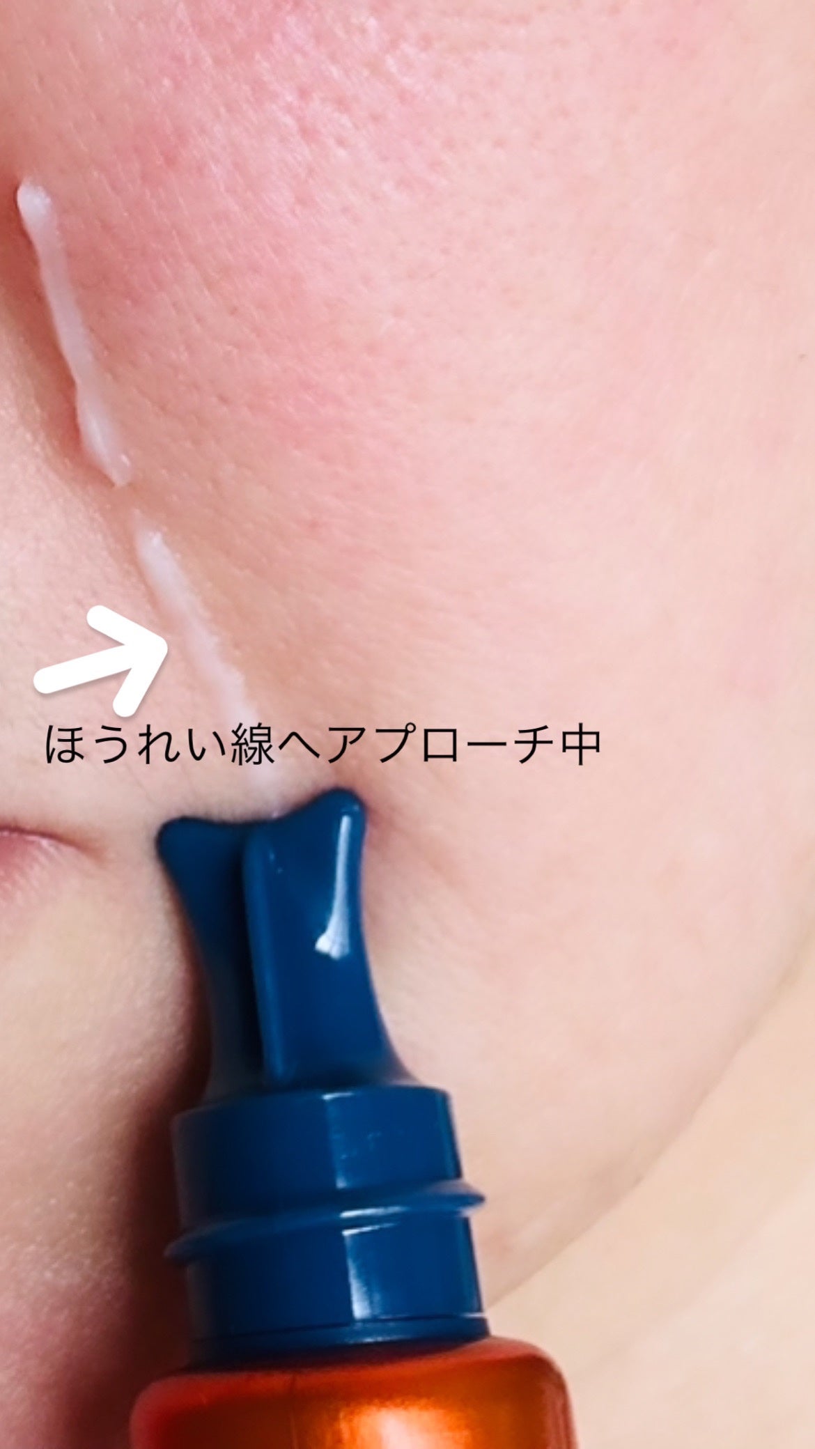 リンクルショット メディカル セラム N/リンクルショット/アイケア・アイクリームを使ったクチコミ(7枚目)