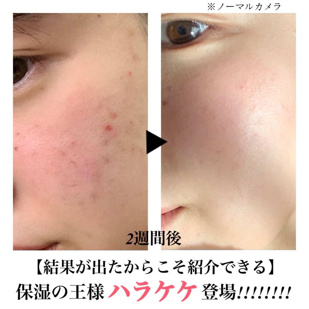 アーバンエコ ハラケケ クリーム/the SAEM/フェイスクリームを使ったクチコミ(1枚目)