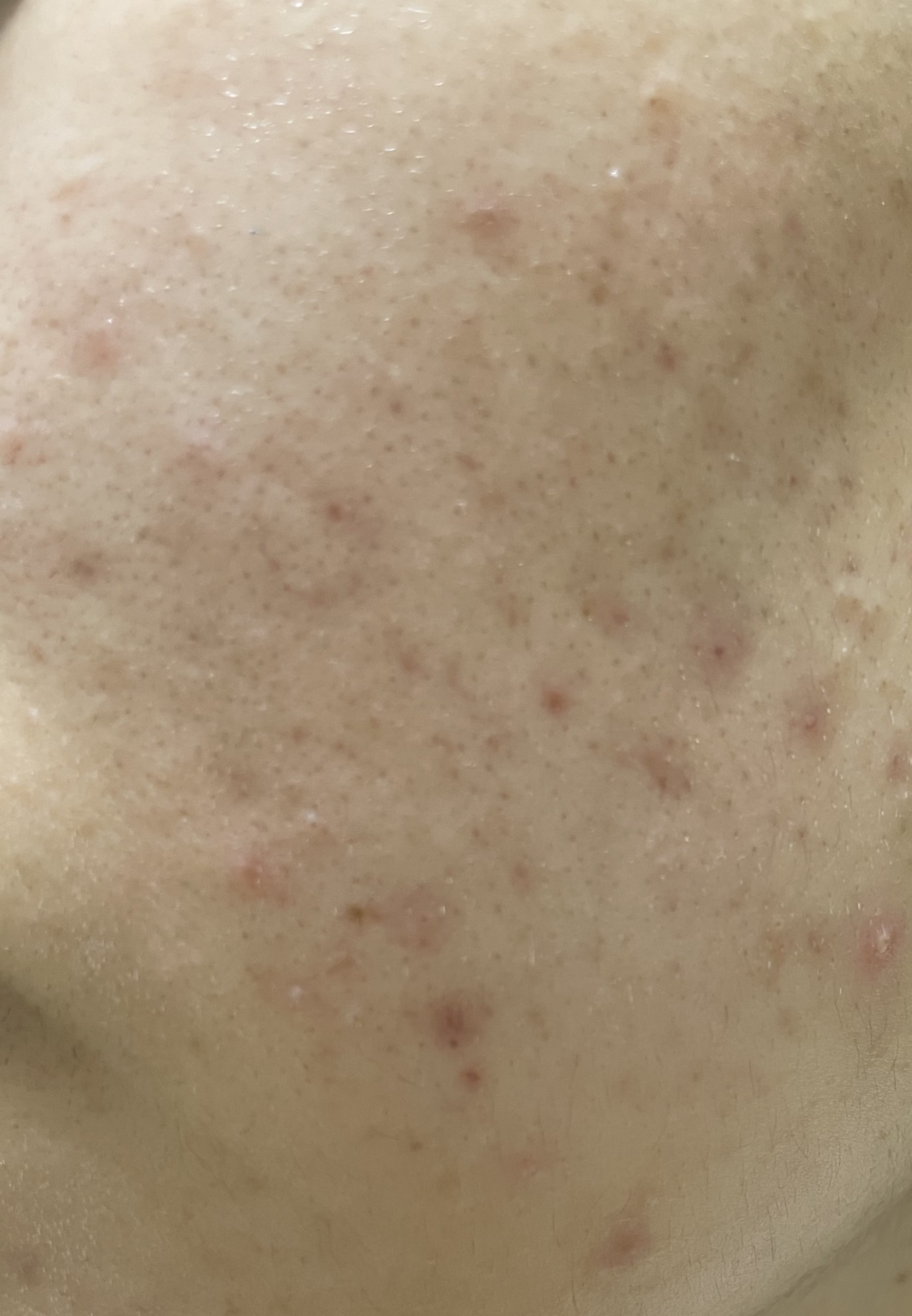 ノーセバム　ミネラルパウダー　N/innisfree/ルースパウダーを使ったクチコミ（2枚目）