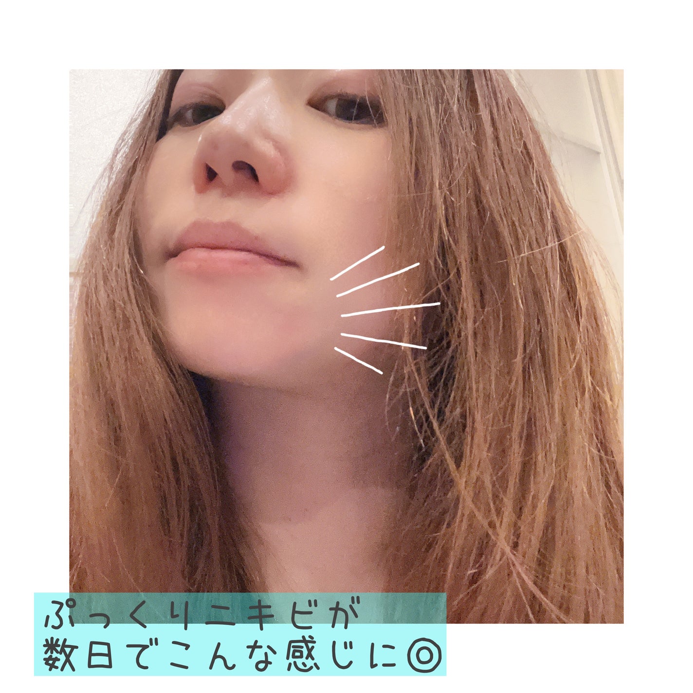 マジックティーツリーオイル/ブラン/フェイスオイルを使ったクチコミ(6枚目)