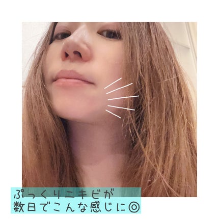 マジックティーツリーオイル/ブラン/フェイスオイルを使ったクチコミ(6枚目)