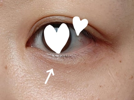 ããã³ ã¢ããã¢ã€ã¹ã ãšã€ãžã³ã°ã±ã¢ ãã€ã¯ãªãŒã UV/ããã³/æ¥çŒãæ¢ãã¯ãªãŒã ã䜿ã£ãã¯ãã³ãïŒ3æç®ïŒ