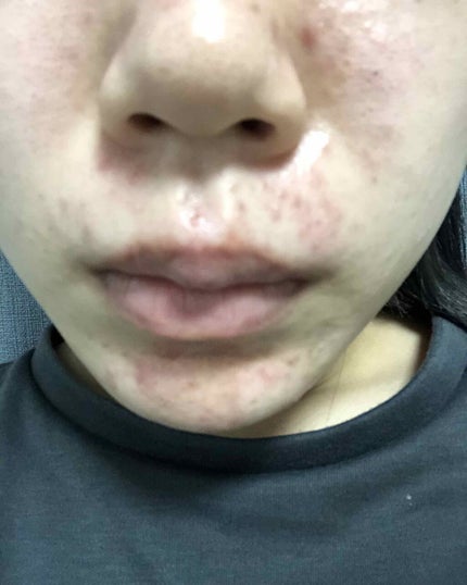 薬用 クリアローション M(しっとりタイプ)/オルビス/化粧水を使ったクチコミ(4枚目)