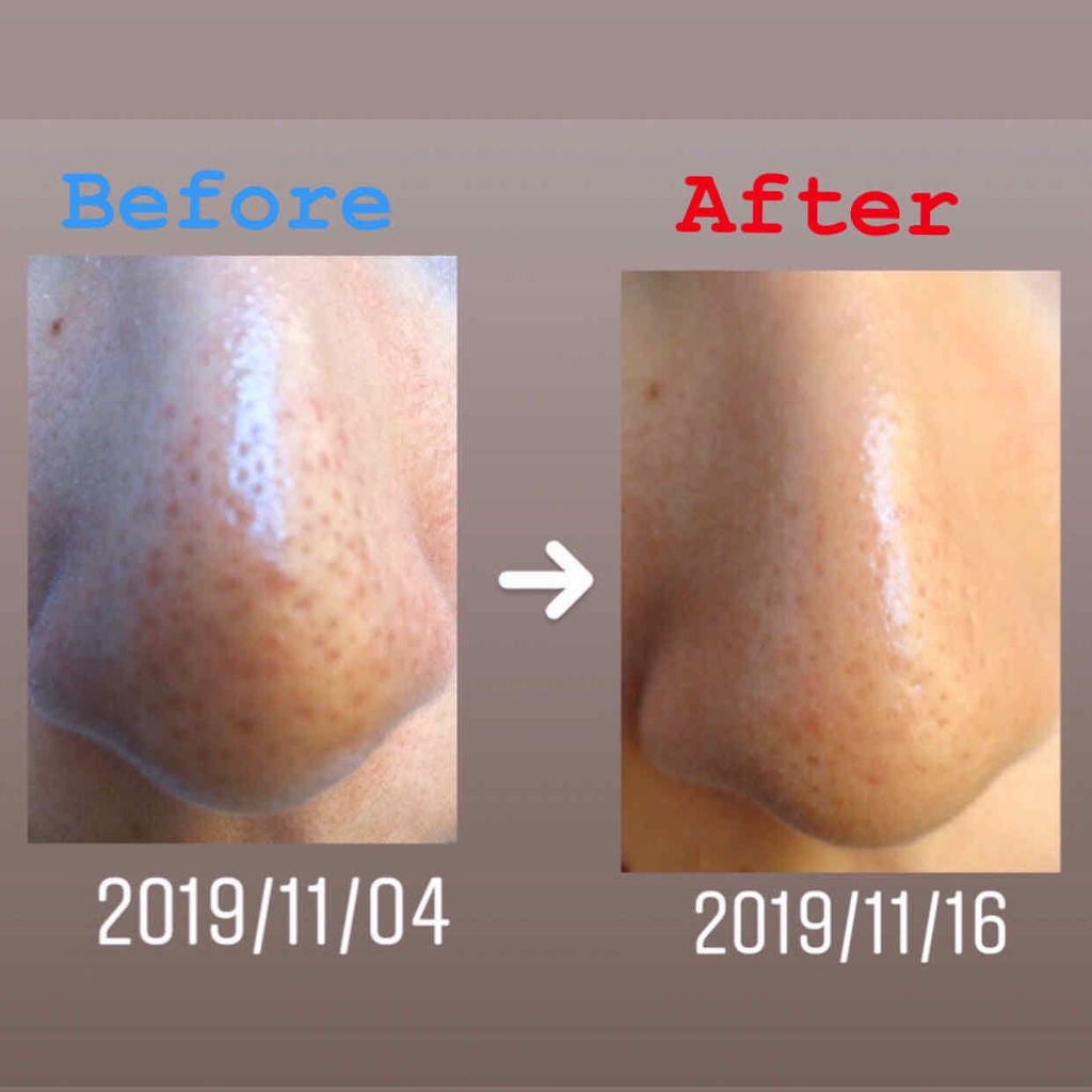 乳液・敏感肌用・しっとりタイプ/無印良品/乳液を使ったクチコミ(2枚目)