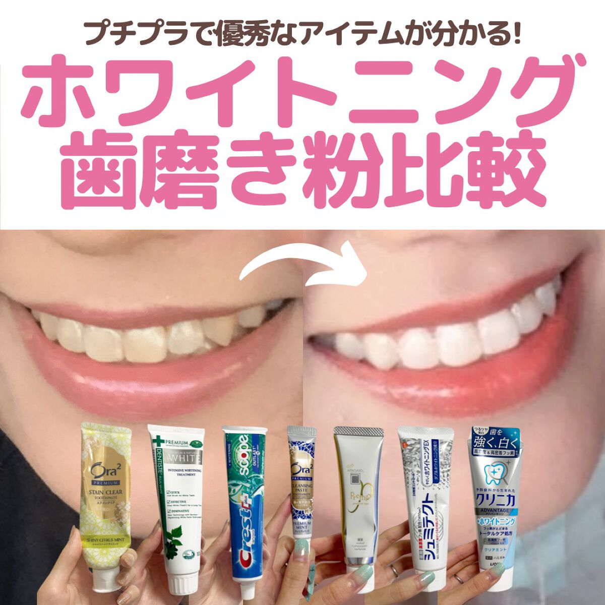 アパガードプレミオ/アパガード/歯磨き粉を使ったクチコミ(1枚目)