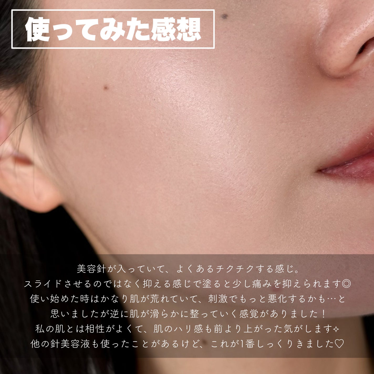 PDRNショット675/COSNORI/美容液を使ったクチコミ(5枚目)