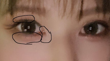 ãã³ã¹ãããã©ã€ããŒ/KATE/ãã³ã·ã«ã¢ã€ã©ã€ããŒã䜿ã£ãã¯ãã³ãïŒ1æç®ïŒ