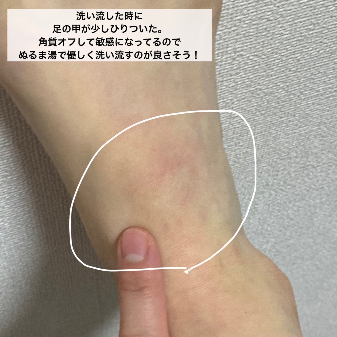 イージーパックDP60分タイプ/ベビーフット/レッグ・フットケアを使ったクチコミ(7枚目)