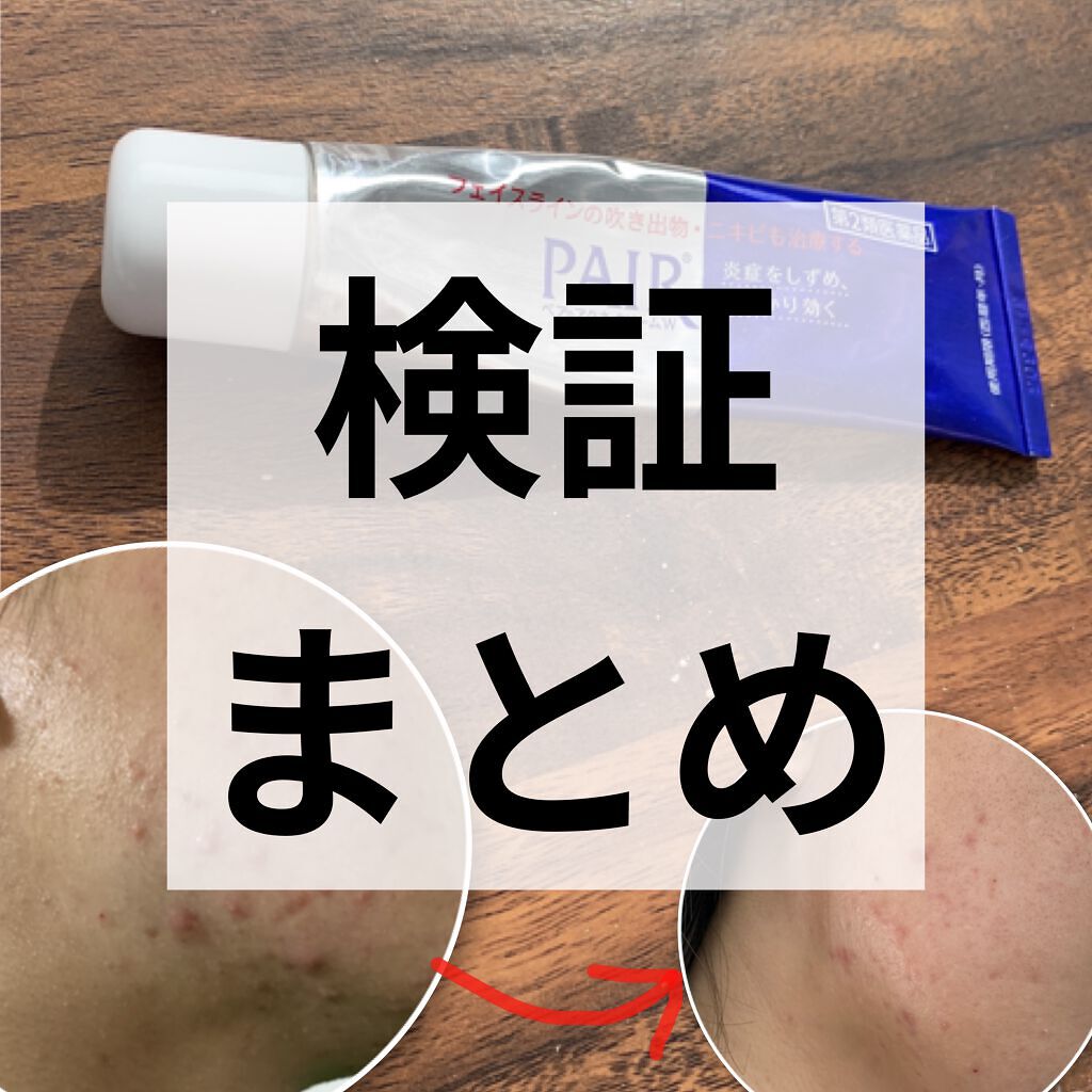 ペアアクネクリームW(医薬品)/ペア/その他を使ったクチコミ（1枚目）