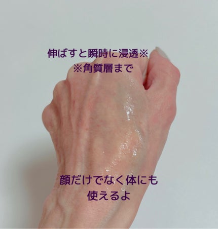 コーライフVC/CO2LIFE/美容液を使ったクチコミ(4枚目)