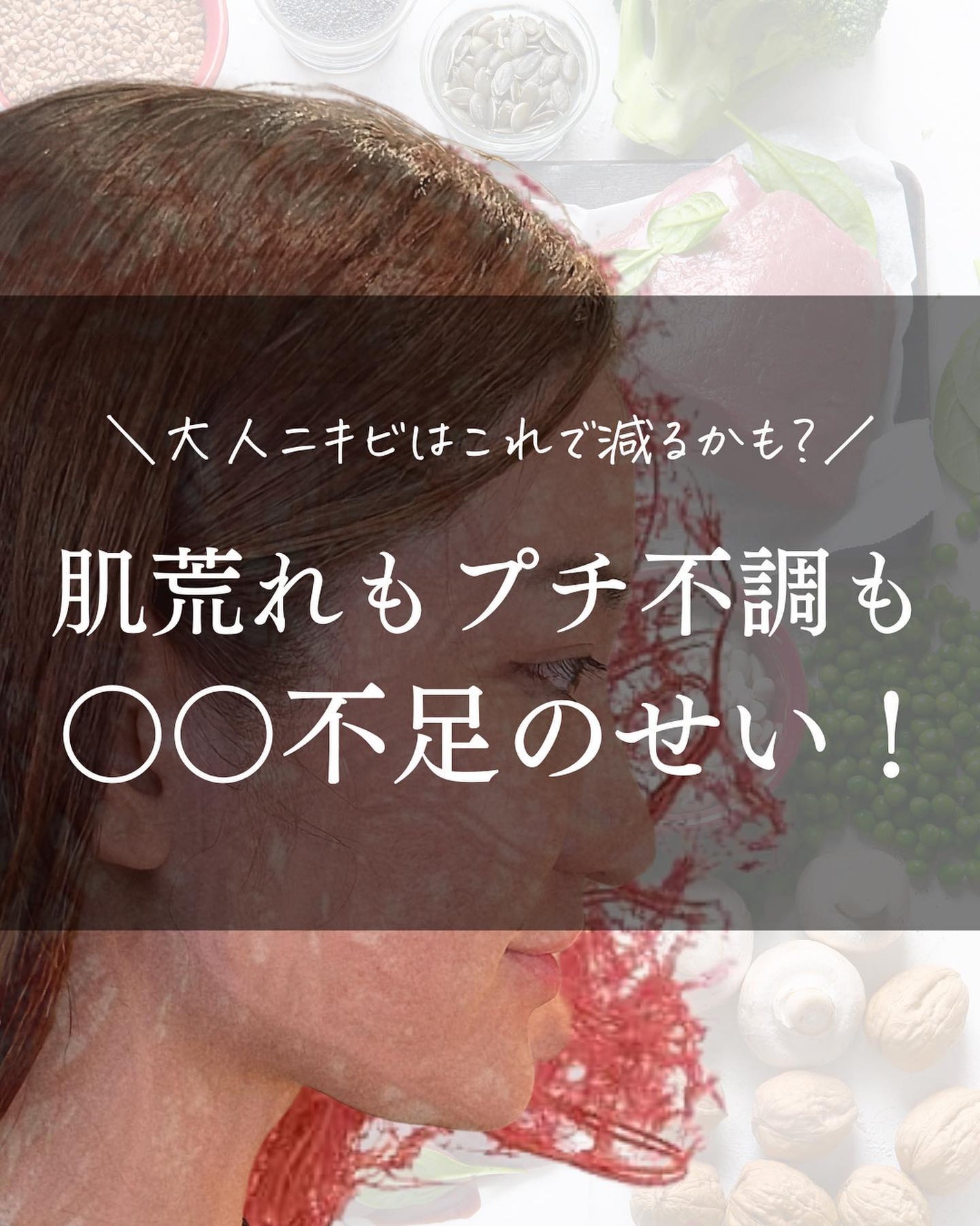 おゆみ|ニキビ・ニキビ跡ケア on LIPS 「【どんだけ大事なの、鉄…】こんばんは。おゆみです。鉄の重要性、..」(1枚目)